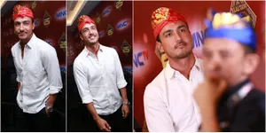 FOTO: Wajah Penuh Baut, Kisah Hamish Daud Amnesia Sampai 9 Bulan