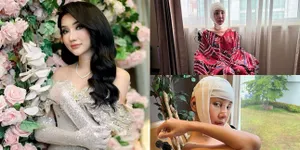 Nekat Operasi Gergaji Rahang dan Potong Tulang Ekor, Potret Terbaru Bibir Lucinta Luna Yang Bikin Netizen Auto Ngilu