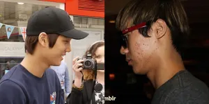 Ouch, Wajah Rupawan Bintang Korea Ini Nyatanya Penuh Jerawat Loh