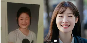 Potret Cantik Jung Chaeyeon Disebut Punya Hasil Operasi Plastik Paling Natural, Akui Memang Oplas
