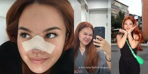 Potret Shafa Harris Jalani Oplas Hidung di Korea Selatan, Ambil Tulang dari Iga - Wajah Masih Bengkak