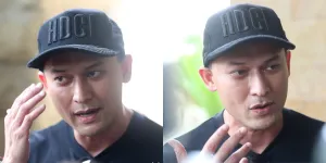 Potret Terbaru Indra Bruggman Usai Lakukan Oplas, Enggan ke Seluruh Bagian Wajahnya karena Alasan Ini