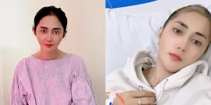 Rambut Botak Karena Kemoterapi, Potret Perjuangan Aida Saskia Lawan Kanker Payudara - Harus Bolak-Balik ke Rumah Sakit