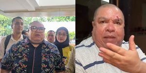 Razman Bawa Enam Bukti Saat Diperiksa Penyidik Terkait Dugaan Penganiaan yang Dilakukan Nikita Mirzani