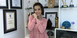 Sheila Marcia Ungkap Proses Hapus Tato di Lengan dan Alis