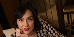 Terungkap Alasan Sara Wijayanto Putuskan Oplas, 2 Kali Gagal - yang Terakhir sampai ke Amerika