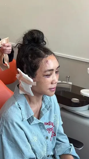 7 Potret Terbaru Ibu Gisella Anastasia Setahun Usai Facelift, Perubahannya Nyata