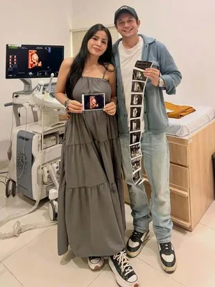 Andrew Andika dan Violentina Kaif Bakal Punya Anak Perempuan, Sempat Salah Siapkan Nama