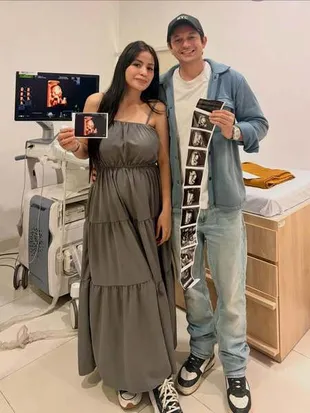 Andrew Andika Terdampak Abu Vulkanik, Batalkan Rencana Babymoon dengan Istri