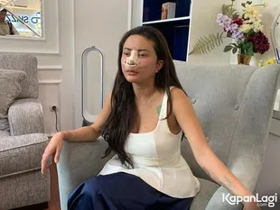Potret Ayu Aulia Oplas Hidung Ke-8, Pilih Pakai Tulang Iga Agar Lebih Awet