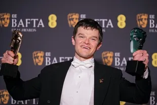 Robert Aramayo Kalahkan Leonardo DiCaprio - Timothee Chalamet di BAFTA Awards 2026