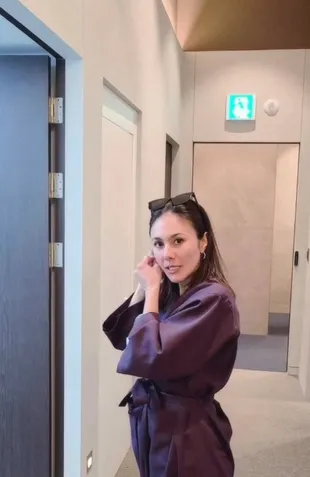 Wulan Guritno Pamer Wajah Usai Oplas, Santai Bareface