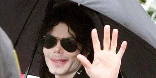 Putra Michael Jackson Mengalami Gejala Vitiligo