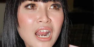 Rini Idol Kaget Wilson Jadi Tersangka Pencabulan