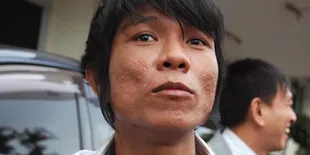 Andika Kangen Band Didera Rasa Rindu