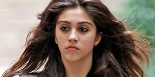 Putri Madonna Terserang Demam Botak