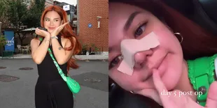 7 Potret Terbaru Shafa Harris Usai Oplas di Korea, Hidung Masih Diperban - Wajah Terlihat Bengkak