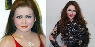 9 Transformasi Artis Sebelum dan Sesudah Lakukan Face Lifting, Langsung Kembali Muda