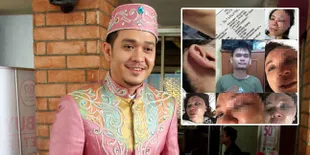 Ada Motif Pemerkosaan di Balik Penganiayaan Adik Fadli &#38; Fadlan?