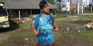 Arya Permana Bocah Obesitas Asal Karawang Kini Berhasil Turun 83 Kg