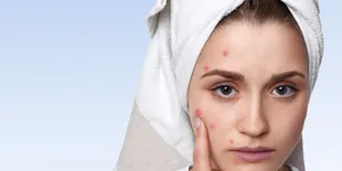 Atasi Jerawat Batu dengan Mudah, Panduan Lengkap untuk Kulit Bersih dan Sehat!