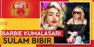 Barbie Kumalasari Sulam Bibir Ditemani Irfan Sbaztian