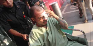 Cairan Kimia Yang Disiramkan ke Beery Manoch Jenis Soda Api