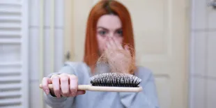 Cara Mengatasi Rambut Rontok Bagi Wanita Berhijab Secara Alami