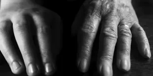 Cara Menghaluskan Kulit Tangan Keriput, Ampuh dengan Bahan Alami