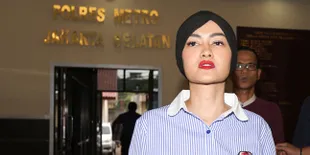 Demam Sudah Turun, Manager Ungkap Kondisi Terkini Julia Perez