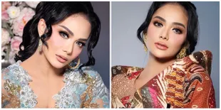 Deretan Operasi Plastik yang Pernah Dilakukan Oleh Krisdayanti, Berani 'Rombak' Tubuh ke Berbagai Negara & Habiskan Ribuan Dolar