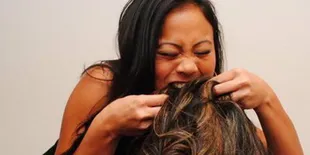 Derita Penyakit Langka, Perut Gadis Ini Dipenuhi Segulung Rambut