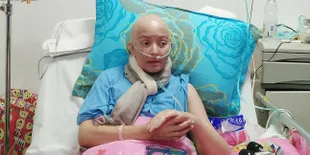 Dibantu Banyak Teman Artis Untuk Pengobatan, Yana Zein Terharu