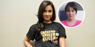 Dibilang Mirip Shandy Aulia, Ini Komentar Anjani Dina