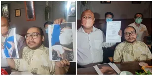 Diseret Ke Aspal Lalu Dipukul Bertubi-tubi, Begini Kronologi Penganiayaan yang Dialami Pemain Sinetron Tuyul &#38; Mba Yul Reborn