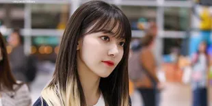 Gaya Rambut Baru Jadi Ombre, Sakura IZONE Tampil Bold &#38; Beda Banget!