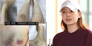 Hadiri Panggilan Polisi, Goo Hara Berikan Penjelasan Langsung Soal Kasus Penganiayaan