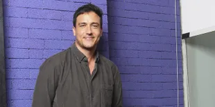 Hamish Daud Tunjukkan Foto X-Ray Tengkorak Kepalanya Penuh Baut, Netizen: Gini Aja Ganteng!