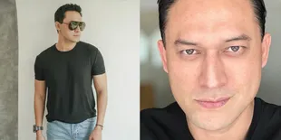 Idap Penyakit Hipertiroid, Indra Bruggman Jalani Operasi Plastik di Korea Selatan Untuk Perbaiki Kondisi Mata