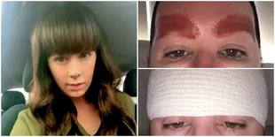 Ingin Lebih Cantik Dengan Tato Alis, Wanita Ini Malah Alami ...