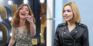 Irma Dharmawangsa Komentari Bibirnya, Barbie Kumalasari: Wah Dia Lagi