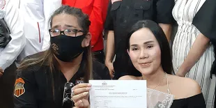 Isa Zega Mantan Manajer Lucinta Luna Dianiaya Sampai Babak Belur dan Hidung Retak