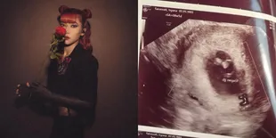 Isyana Sarasvati Alami Keguguran, Bagikan Hasil Foto USG Sang Malaikat Kecil dengan Denyut Jantung Janin Negatif