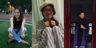 Jelang Ajal, Gadis Ini Sumbang Kepala Untuk Jadi Objek Penelitian