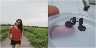 Karena Anting Rp 15 Ribu, Cewek Ini Harus Jalani Operasi Telinga!