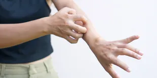 Kenali dan Atasi Ruam Kulit, Panduan Lengkap untuk Mengidentifikasi Ciri-Ciri Berbagai Jenis Ruam!