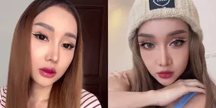 Lebih dari 18 Kali Operasi, Lucinta Luna Ungkap Punya Tabungan Hasil Jadi Kupu-Kupu Malam - Sekali Ketemu Kantongi Ratusan Juta