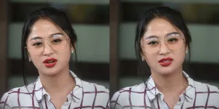 Kondisi Ayah Membaik, Dewi Perssik Batal Cari Pendonor Ginjal