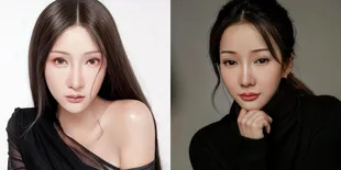 Kontroversi Lucinta Luna yang Ungkap Transformasi Gender