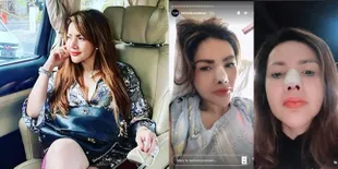 Korbankan Tulang Telinganya, 8 Potret Terbaru Barbie Kumalasari Usai Jalani Operasi Hidung: Bisa Jebol!